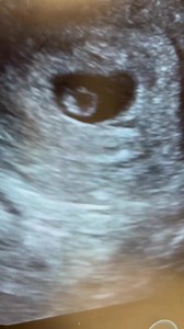 1.5K views | From Bump To Baby At our Private Pregnancy Scanning...