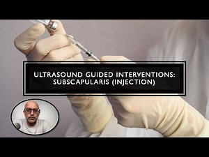 Ultrasound Guided Interventions: Subscapularis Tendon (Injection) #ultrasound