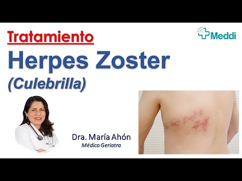Herpes Zoster: Diagnóstico y Tratamiento
