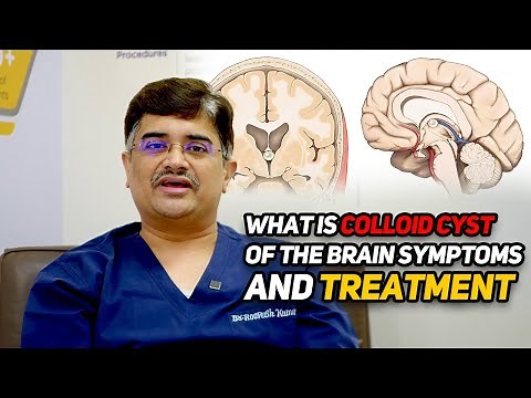 What is colloid cyst of the brain; symptoms and treatment|Dr.Roopesh Kumar