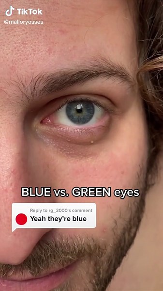Blue vs. Green Eyes: Understanding the Differences