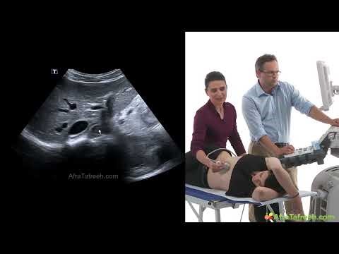 Liver Sonography Made Easy | How to Scan the Liver (Part 1 - 03)