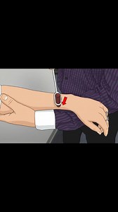 The inverted brachioradialis reflex evaluates for C5 C6 neck lesions. The patient’s forearm is placed in a relaxed, pronated position, resting on the examiner’s forearm, and the examiner delivers several brisk strikes with a reflex hammer near the radial styloid at the insertion of the brachioradialis tendon. A normal or negative response consists of wrist pronation with elbow flexion due to brachioradialis contraction. A positive or abnormal response is characterized by finger flexion with rela