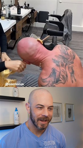 128K views · 350 reactions | Dermatologist reacts to EXTREME waxing! #waxing #menswax #dermreacts #doctorreacts | Dr. Dustin Portela, Dermatologist | Facebook