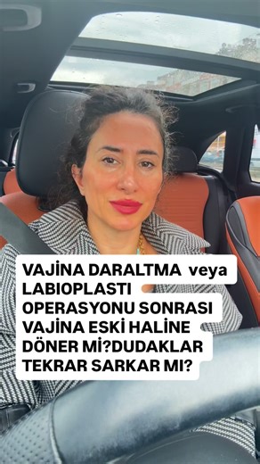 Pervin Karlı on Instagram: "• Normal doğum yapılırsa • Tekrarlayan travmalar olursa (zor doğum, ağır kaldırma, bağ dokusunu zayıflatan faktörler) • Yaşlanmaya bağlı doku elastikiyet kaybı gelişirse • Yani vajina “eski haline tamamen dönmez”, fakat yukarıdaki faktörler etki ederse bir miktar gevşeme olabilir. Genellikle ilk operasyona göre daha toparlanmış kalır. Labioplasti (İç Dudak Estetiği) Sonrası • İç dudaklar (labium minus) küçültülüp şekillendirildikten sonra genellikle tekrar uzama/sarkm
