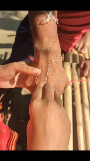 4.7K views · 55 reactions | Always follow non touch technique this insertion is so much unsterile #viralpost2025シ #viralreelsシ #foryoupage #foryouシ #cannulatechnique #nursing #nursingstudent #AllStudents | Mobassera Akanda | Facebook