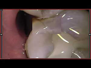 CADI basic functions