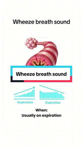 What a Wheeze Sounds Like in Asthma