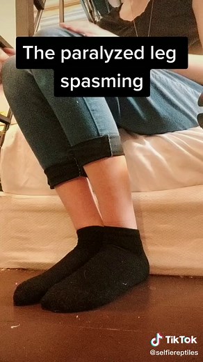 #paraparesia #neurologicaldisorder #paralysis