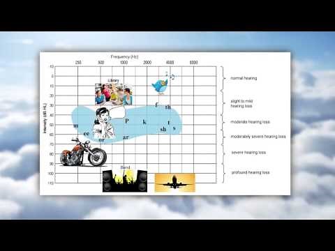 Understanding your hearing chart