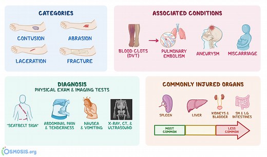 Blunt Trauma: What Is It, Diagnosis, Outcomes, and More | Osmosis