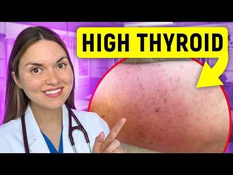 19 Signs of HYPERTHYROIDISM (Graves Disease) You Can See: Doctor Explains