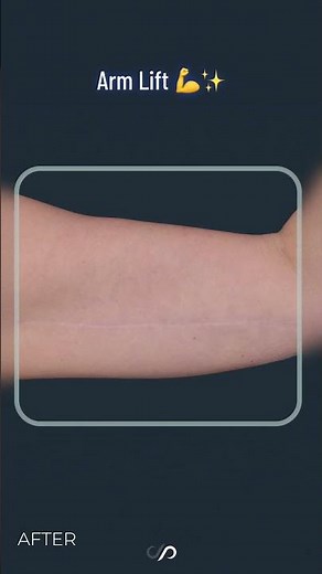 Get rid of saggy arms with this simple technique