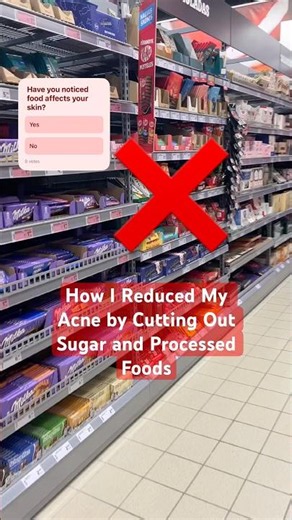 How I Reduced My Acne by Cutting Out Sugar and Processed Foods