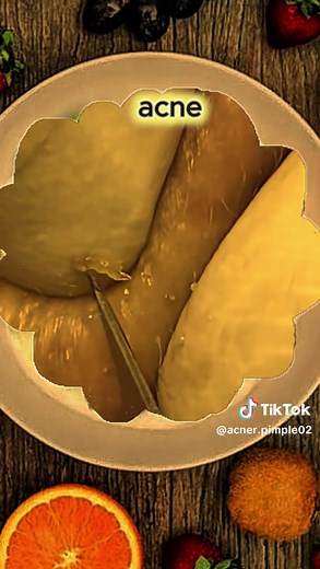 #blackhead #satisfying #fyp #tiktok #foryoupage