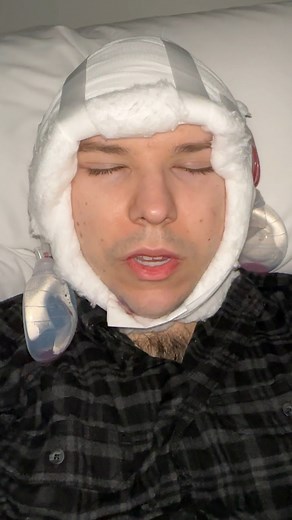 My head sliced open | Nikocado Avocado