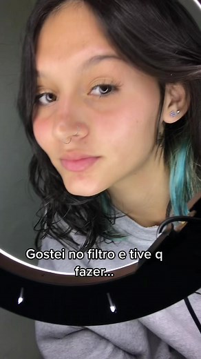 Teal-Haired Influencer Reveals Cosmetic Procedure Results