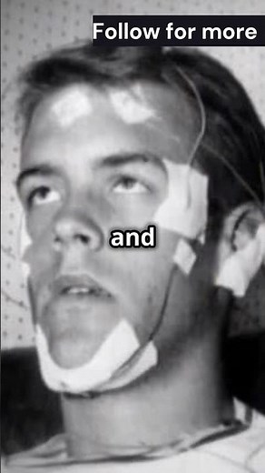 The Man Who Survived Without Sleep!!