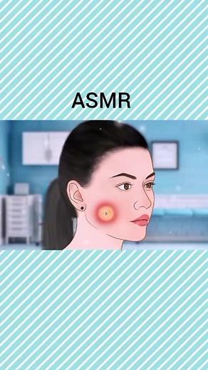 Gentle ASMR Medical Treatment for Relaxation