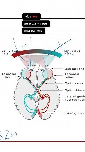 Bitemporal Hemianopia Explained #neuroanatomy
