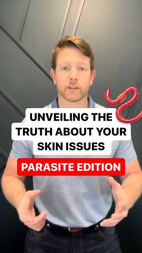 Parasites👏 can👏 cause👏 skin👏 issues👏 That’s right. Parasites range from microscopic to large creatures that can live inside the human body. These parasites can cause various skin issues, including rashes, itching, and hives. 🪱When parasites infect the body, they release toxins that can trigger inflammation and irritation, leading to skin conditions such as eczema and psoriasis. 🧪One challenge in dealing with parasites is the difficulty in diagnosing them, as testing for parasites can be E