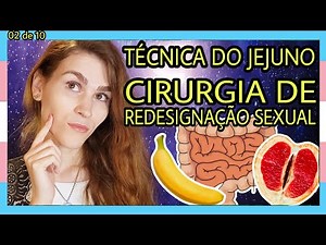 [284] Técnica do Jejuno; como é feita a cirurgia de redesignação sexual do Dr. Marcio Littleton