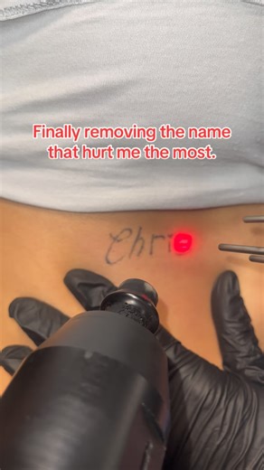 DTown Laser Tattoo Removal on Instagram: "Don’t let your ex’s name live rent free on your skin.🤢 To book for first appointment book free consultation - •📞(800) 774-9058) •📲(214)971-1475) •📍5510 Abrams Rd #103, Dallas, TX 75214 •💌click link in bio to book #ex #fyp #lasertattooremoval #dallastx"