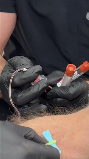 Behind the Scenes: PRF Blood Draw Process #shorts