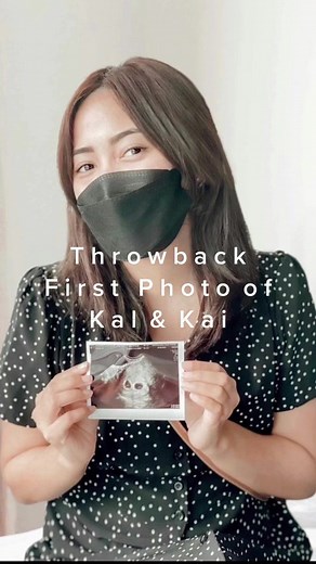 Pregnancy Week 5 Ultrasound: Twin Babies' First Glimpse