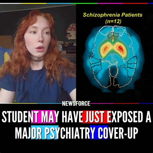 🚨DID THIS STUDENT RESEARCHER JUST SOLVE SCHIZOPHRENIA?A young woman is going viral after breaking down her research paper claiming modern psychiatry has been focusing on the wrong part of the brain for decades. She argues schizophrenia isn’t primarily a dopamine disorder, but a “leaky thalamus” — the brain’s sensory filter — that fails to block out irrelevant information, causing the brain to hallucinate and create its own reality to fill in the gaps.Her theory also suggests antipsychotics only