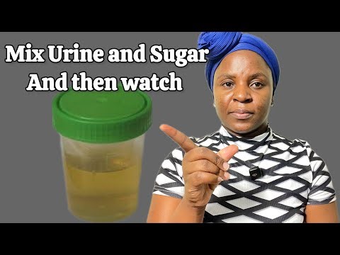 Mix Urine and Sugar—Secret Nobody Will Ever Tell You About!