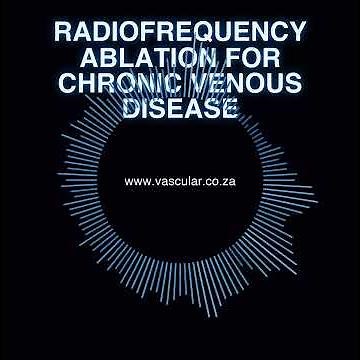 MET - 71 - Radiofrequency Ablation for Chronic Venous Disease - Brief
