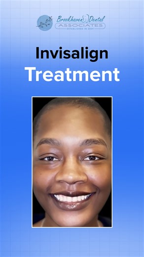 41 reactions · 11 shares | ✨ Straight teeth. Clear confidence. 醴 Invisalign results hit different when you see your smile glow up for real.  No wires. No stress. Just vibes and results you can flex every day. Ready to start your transformation? Tap the link in our bio to book your Invisalign consultation! #BrookhavenDentalAssociates #InvisalignResults #ClearAligners #SmileTransformation | Brookhaven Dental Associates, Atlanta, GA | Facebook