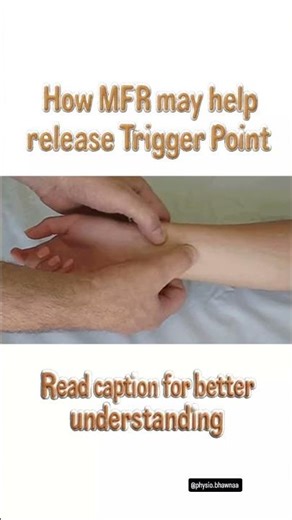 How mfr may help release trigger point