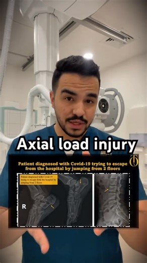 Axial load injury 👊🏻