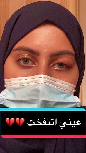 Treatment and Causes of Eye Swelling: A Comprehensive Guide