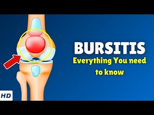 Bursitis – Types, Causes, Signs and Symptoms, Diagnosis & Treatment