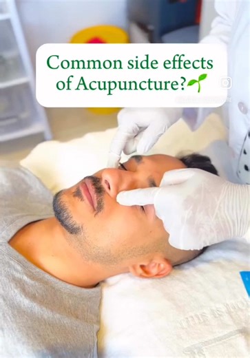 Let’s clear this up, Common side effects—>Benefits✨ #acupuncture #chinesemedicine #blissfulacupuncture #drprinishajugroop #capetownacupuncture