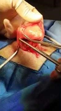 Say Goodbye to Bleeding & Long Procedures! The Veterinary Ligasure, Redefining Surgical Efficiency.