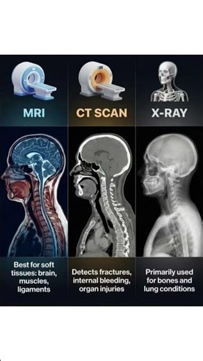 MRI vs CT Scan vs X-Ray | Medical Imaging