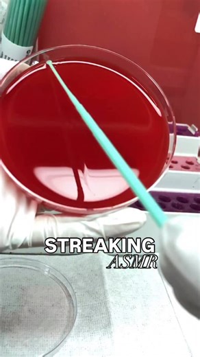 The REAL Streaking in the laboratory 😜👀 This is how we place bacteria onto a petri dish in the lab. When a sample comes in, like urine, a throat swab, or sputum, we don’t just dump it onto the plate and hope for the best. We carefully spread the sample across the surface of the agar so any bacteria present can grow in an organized way. This process is called streaking, and it allows us to see what organisms are actually there. From a lab and ASCP perspective, streaking can be done quantitative
