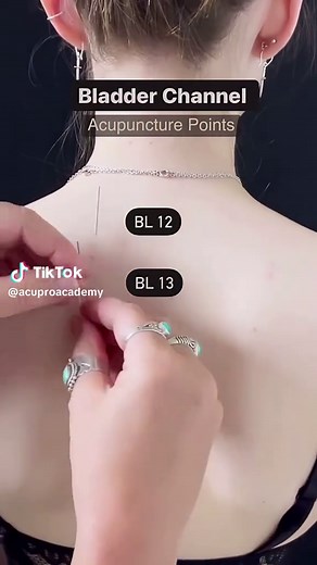 Needling Bladder Acupuncture Points for Health Benefits