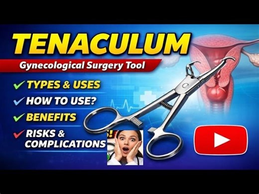 TENACULUM - Definition ,types , parts, uses , Precautions, How to use ? -… | Prof . M THANGA DARWIN