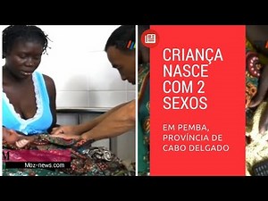 Criança nasce com dois sexos (hermafrodita) em pemba
