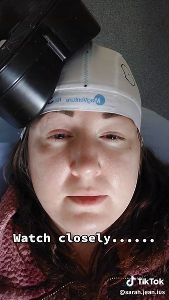 Revolutionary RTMS treatment. I had it done a few years ago and it did wonders for my depression. Here's hoping it works again 😀 #depression #anxiety #rtms #tms #treatment #hope