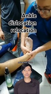 Ankle dislocation relocation