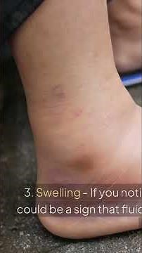 7 Leg Circulation Warning Signs You Should Know! #shorts