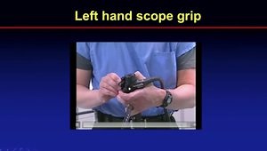 Polyp Resection: Five Things You Probably Are Not Doing but Should