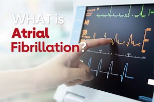What is Atrial Fibrillation?