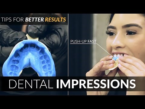 Dental Impression Tips for Cosmetic Dental Veneers w/ Snap On Smile Makeovers by Brighter Image Lab